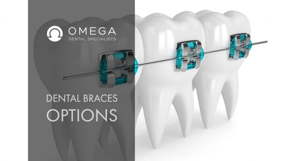 cost of metal braces in Houston