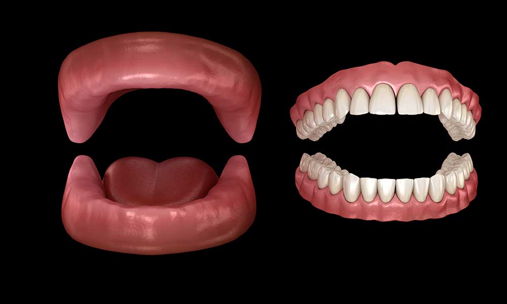 is alveoloplasty for dentures