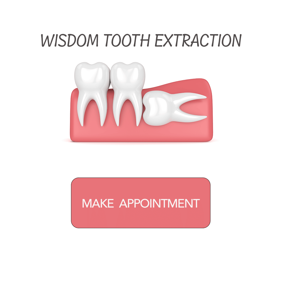 Wisdom Tooth Removal